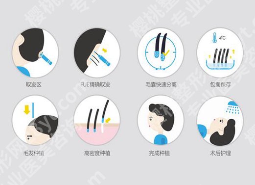 台州医院植发价格是多少？过来人揭晓费用明细、真实案例曝光