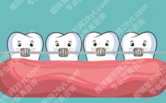 汉中中心医院牙齿正畸怎么样？矫治器选择与疗程安排详解