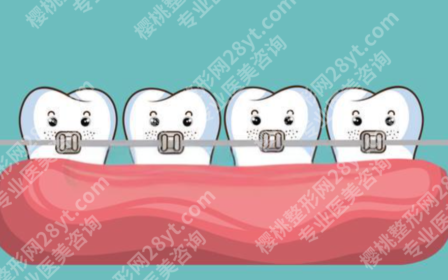 汉中中心医院牙齿正畸怎么样？矫治器选择与疗程安排详解