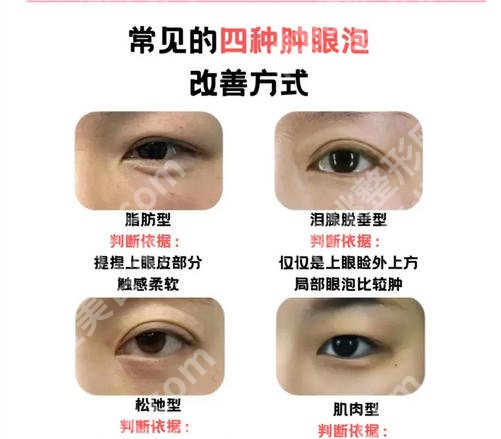 武汉排名前十双眼皮修复医生名单公布！冯晓玲/王介聪排名靠前！