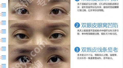 西安双眼皮修复医生排名曝光！专家实力大比拼！