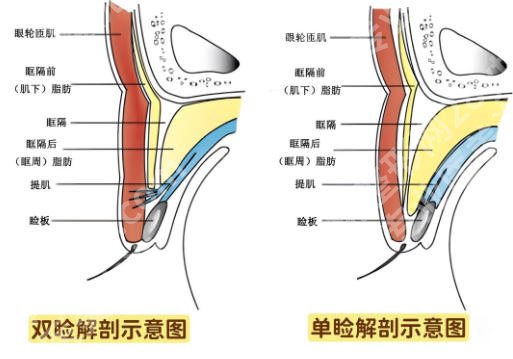 泉州排名前十双眼皮修复医院名单公布！top榜前五名单一览！