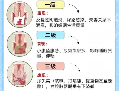 广州三甲医院做紧缩手术要多少钱?26年最新价格表一览!