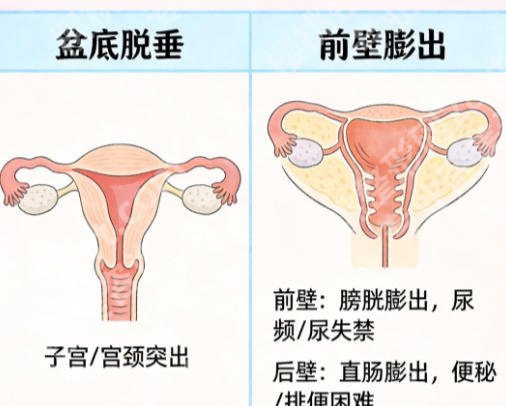 深圳哪家医院做完紧缩术好?新技术医院实力盘点!