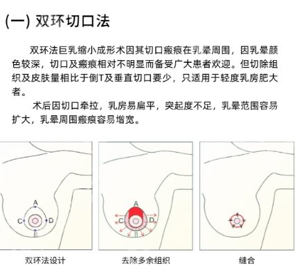 刘文阁是正规手术医生吗？医生资质点评！附缩胸案例