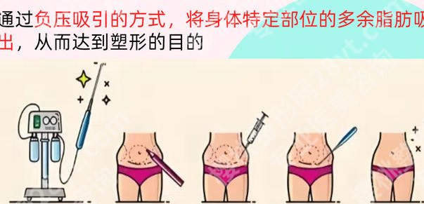 刘文阁医生怎么样？2026求美者真实反馈参考！附价格表
