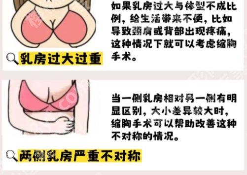 杭州哪里可以做缩胸手术？汇总正规有技术的3家！