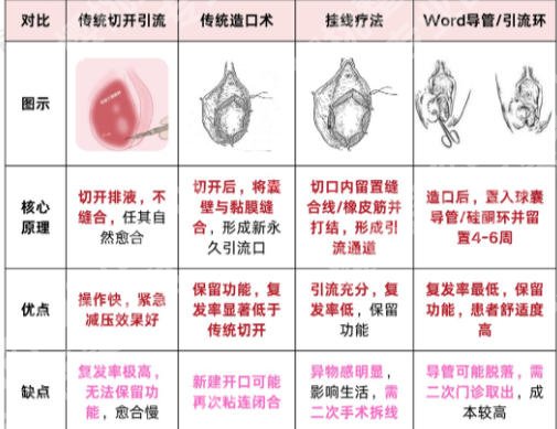 上海做缩紧手术可以报医保吗?正规口碑医院更新
