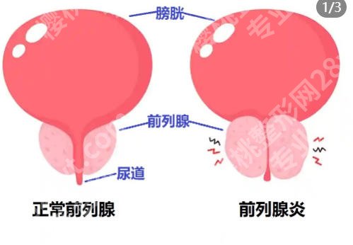 武汉增肥医院哪家好?关于武汉靠谱医院！这篇笔记讲透了