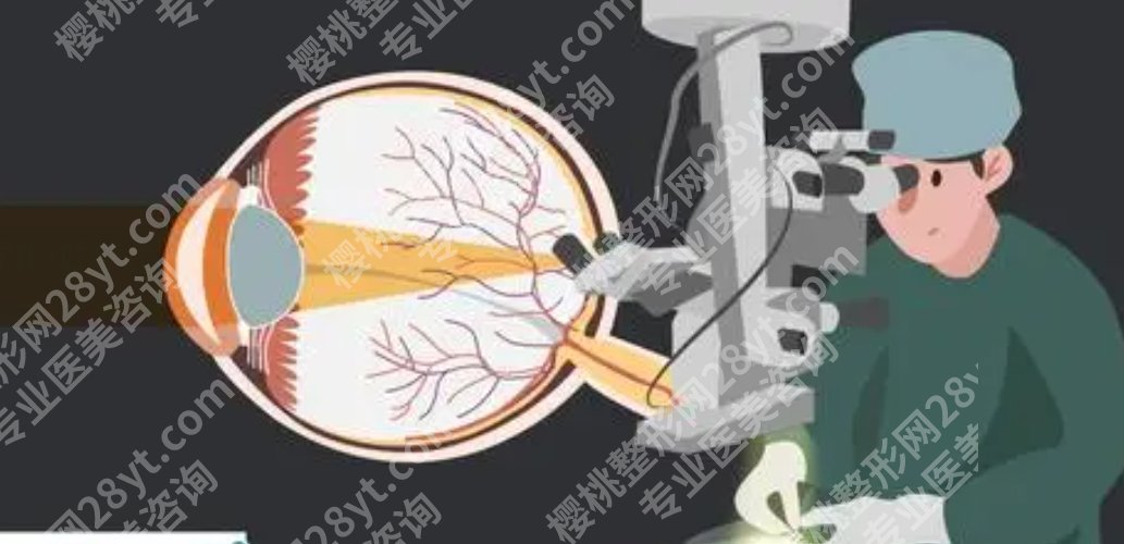 北京大学深圳医院激光近视手术技术如何?激光近视手术案例