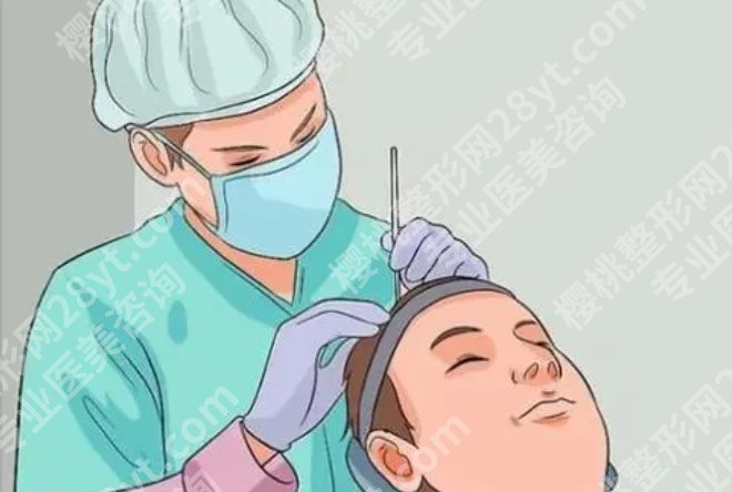 合肥第二人民医院植发怎么样？戳进来看2026年顾客实例！