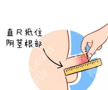 重庆大坪医院延长术如何?院内哪位医生技术好?附上案例