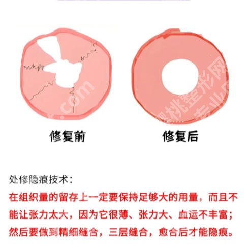 哈尔滨哪个医院处修手术？优质医院榜单来袭！