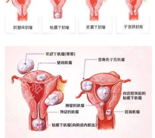 兰州紧缩针哪个医院好？前五优质机构精选榜单出炉！