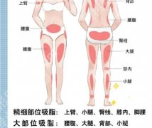安徽医科大学第二附属医院吸脂价格揭晓！26年最新价格表一览
