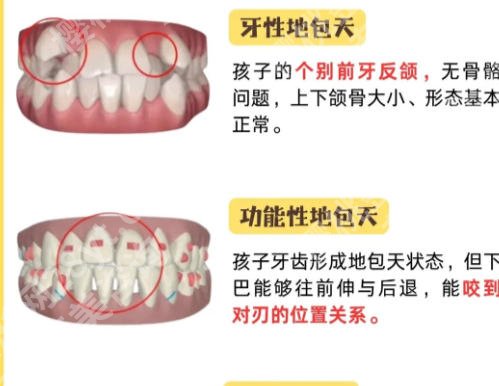 绍兴人民医院矫正牙齿多少钱？医生与价格表详情！