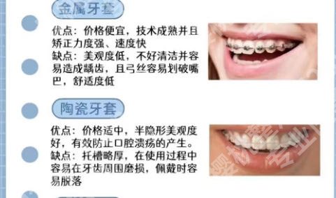 中山正畸哪个医院好？五家优质医院等你来选！