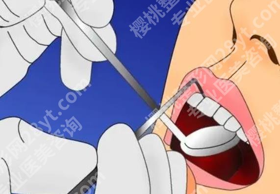 上海九医院口腔外科医生排名|杨驰、何冬梅、邹多宏等热度不减！