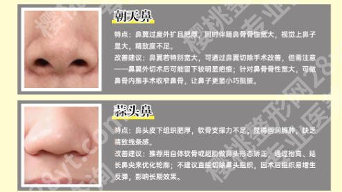 深圳人民医院美容科怎么样？实打实经历这速看！