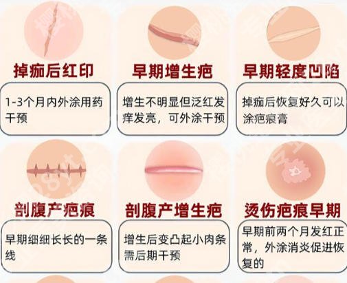 上海第八人民医院去疤痕多少钱？揭晓收费明细与避坑指南