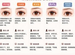 小榄人民医院双眼皮多少钱？高性价比、内附价格表和案例分享！