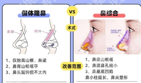 上海同济医院假体隆鼻怎么样？过来人实测分享、避坑不踩雷！