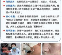 海南省人民医院点阵激光怎么样？认证专家权威发布
