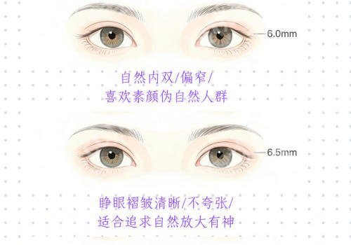 蚌埠医学院附属医院做双眼皮怎么样?双眼皮案例分享及基本信息分享!
