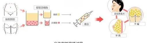 安徽医科大学第一附属医院整形科怎么样？核心项目有哪些
