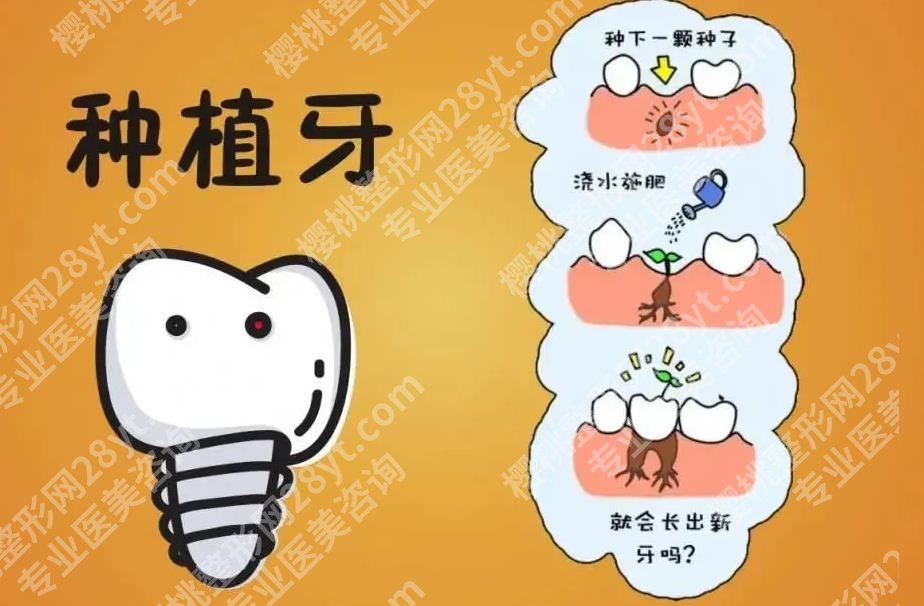 重医附二院种植牙贵不贵？技术优势及真人种植牙术后反馈来袭！