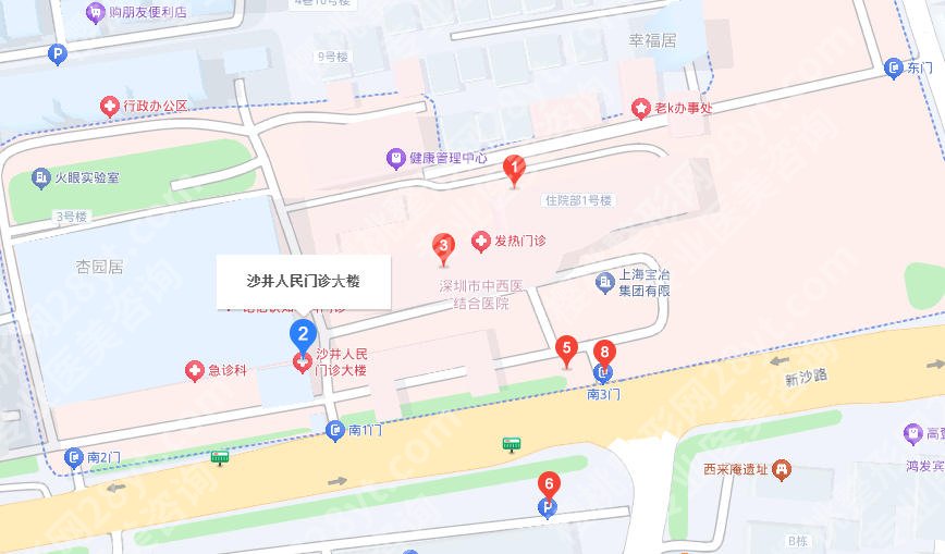 沙井人民医院割双眼皮多少钱?张军医生实操案例及收费标准分享!