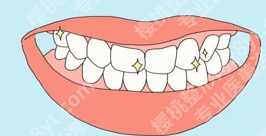 濮阳三院牙齿矫正怎么样？秦桂梅、孟宪瑞等技术pk！