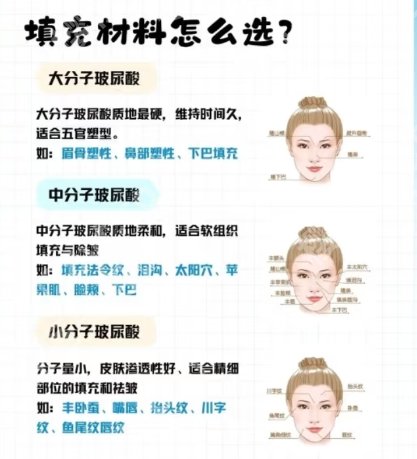 北京301医院脂肪填充怎么样？安全系数如何？案例鉴赏