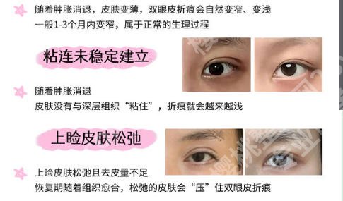 深圳协和医院美容科简介来袭！医团队与热门手术效果大盘点