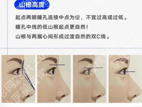上海中山医院双眼皮价格揭示！感兴趣的快来看！