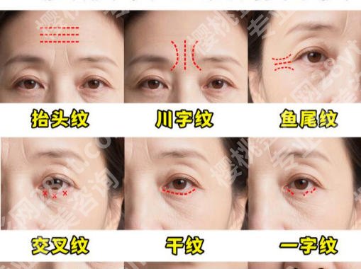 广州红十字会医院整形科怎么样？口碑评价与适合人群分析