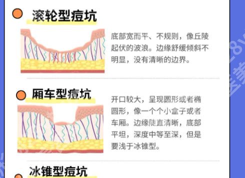 北京医院点阵激光价格对比详细来袭！费用信息、避坑指南公布