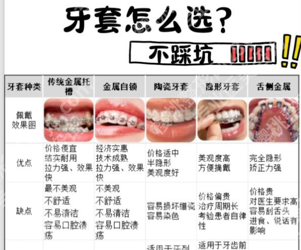 汕头中心医院矫正牙齿技术怎么样？2026费用更新！戳进来看
