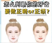 上海国际医学中心正颌手术费用表更新！沈国芳/史俊医生口碑好！