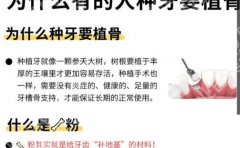 武汉同济医院种植牙多少钱？各项目费用详情及收费标准查询