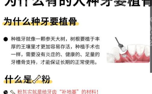 武汉同济医院种植牙多少钱？各项目费用详情及收费标准查询