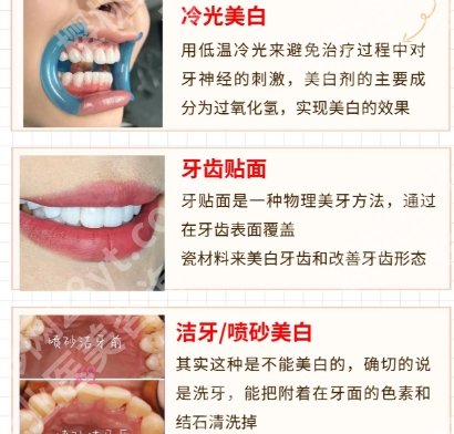 南方医院牙齿美白多少钱？2026费用低至1000左右起！
