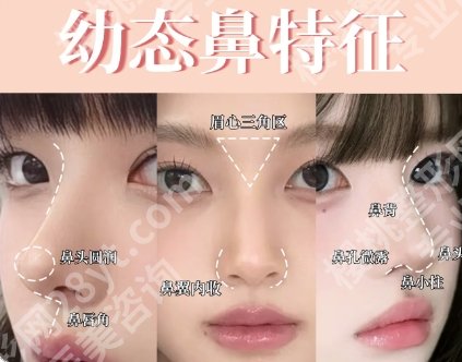 金华第五医院假体隆鼻价格|公立医院收费解析！12000-17000元