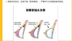 上海东方医院隆胸价格揭晓！医生名单与科室信息简介