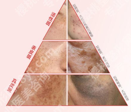 汕头中心医院整形美容科怎么样？2026客户口碑真实附上！