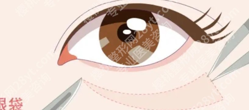 宁波第六医院祛眼袋多少钱?当地参考5093元起!口碑医生介绍