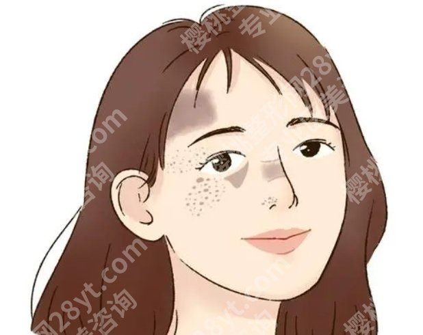 宁波第二医院祛斑怎么样？斑点去除案例曝光！附收费表
