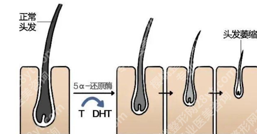 徐州二院植发技术如何?2026年植发案例库更新!费用参考