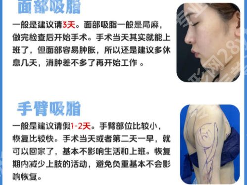 上海九院抽脂怎么样？口碑技术专家大盘点！速速来看