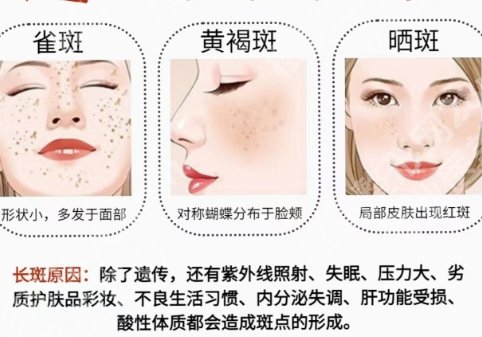 上海第八人民医院激光美容科怎么样?激光祛斑案例展示!